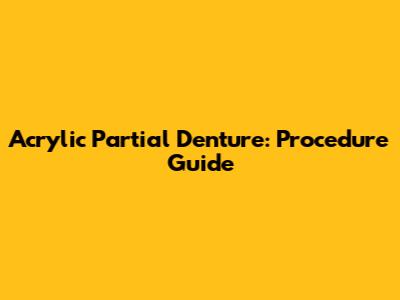 Acrylic Partial Denture: Procedure Guide