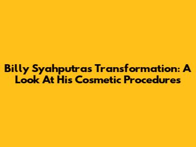 Billy Syahputra's Transformation: A Look At His Cosmetic Procedures