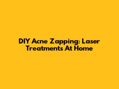 DIY Acne Zapping: Laser Treatments At Home