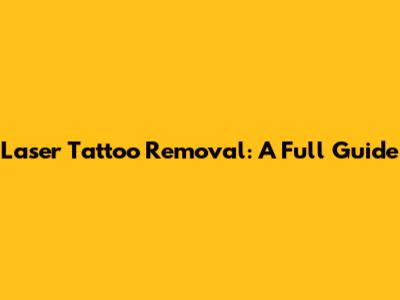 Laser Tattoo Removal: A Full Guide