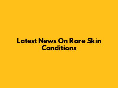 Latest News On Rare Skin Conditions
