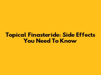 Topical Finasteride: Side Effects You Need To Know